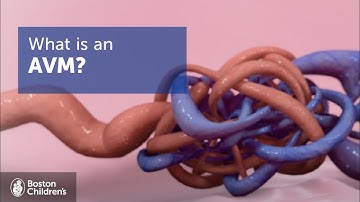 Arteriovenous Malformations (AVMs) | Boston Children