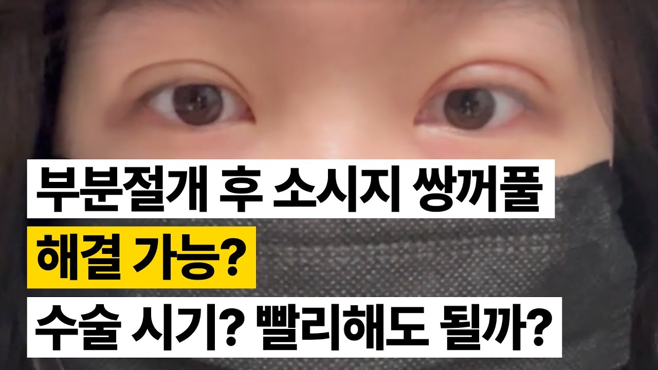 [Ганнам Соён гоо сайхны мэс заслын эмнэлэг] Гоо сайхны мэс заслын зөвлөгөөний төв 💌 Хэсэгчилсэн зүсэлт хийлгэсний дараа үүссэн хиам шиг давхрагыг засах боломжтой юу? Мэс заслыг хэзээ хийлгэх вэ? Хурдан хийлгэж болох уу?