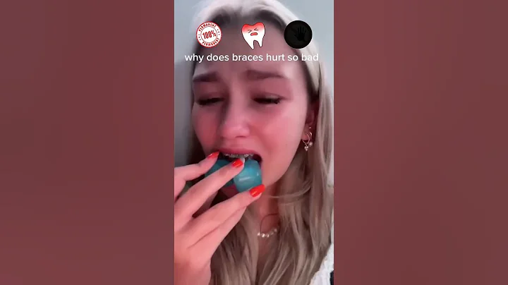 Braces Myths 𤯠- DayDayNews