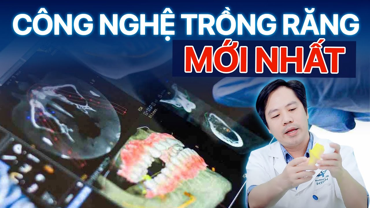 Outline Video Công Nghệ Trồng Răng Mới Nhất 2025: Top 6 Công Nghệ Dẫn Đầu Xu Hướng