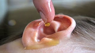 How To Remove Earwax At Home | Amazing Home Remedies | Nutshell School