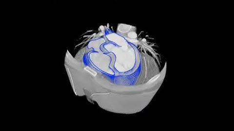 Cardiac model fitting
