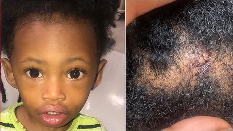 2-Year-Old Grazed By Bullet Inside High Point Home During Shooting