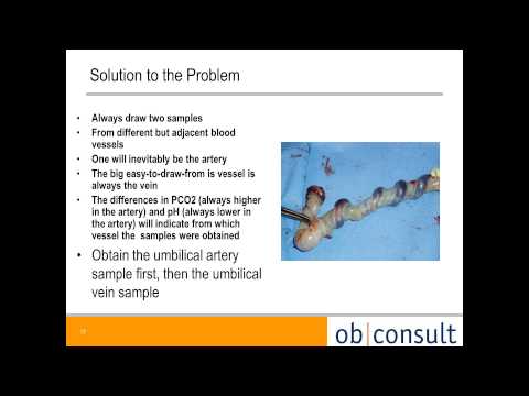 Fetal Acid Base Status and Umbilical Cord Sampling presented by Dr