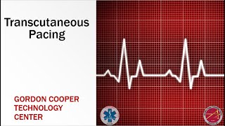 Paramedic - Transcutaneous Pacing