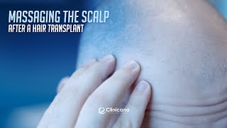 Massaging The Scalp After A Hair Transplant screenshot 3
