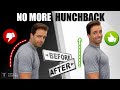 Fix Your Posture! 10-Minute Routine To Eliminate “Hunchback”