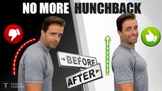Fix Your Posture! 10Minute Routine To Eliminate “Hunchback”
