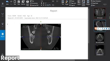Orthodontic Case Report Dental Cone Beam CT software Single function display - LargeV SmartVPro