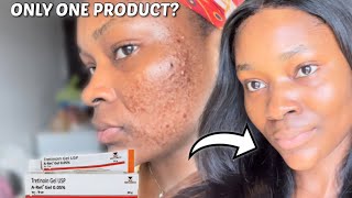 HOW TO ACHIEVE YOUR DREAM SKIN WITH TRETINOIN | How to use Tretinoin for beginners #tretinoin