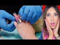 ANILLO CARÍSIMO DE DIAMANTE ATASCADO EN MANO DE MUJER 😱 (LE VAN A CORTAR EL DEDO!) 💍| Mariale