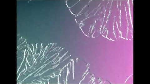 Squarp Hermod and Op-1