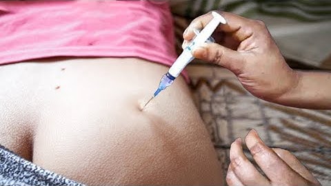 Intramuscular Injection in Buttocks | Step by Step IM Injection Guide for Nurses