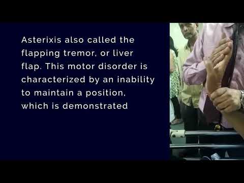 Video: Asterixis: Årsaker, Behandling, Relasjon Til Leveren Og Mer