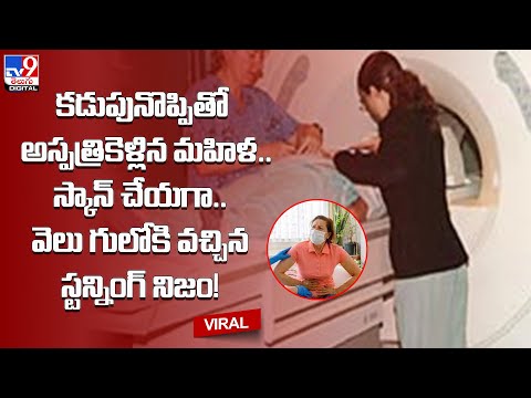 కడుపునొప్పితో అస్పత్రికెళ్లిన మహిళ.. స్కాన్ చేయగా వెలుగులోకి వచ్చిన స్టన్నింగ్ నిజం! - TV9