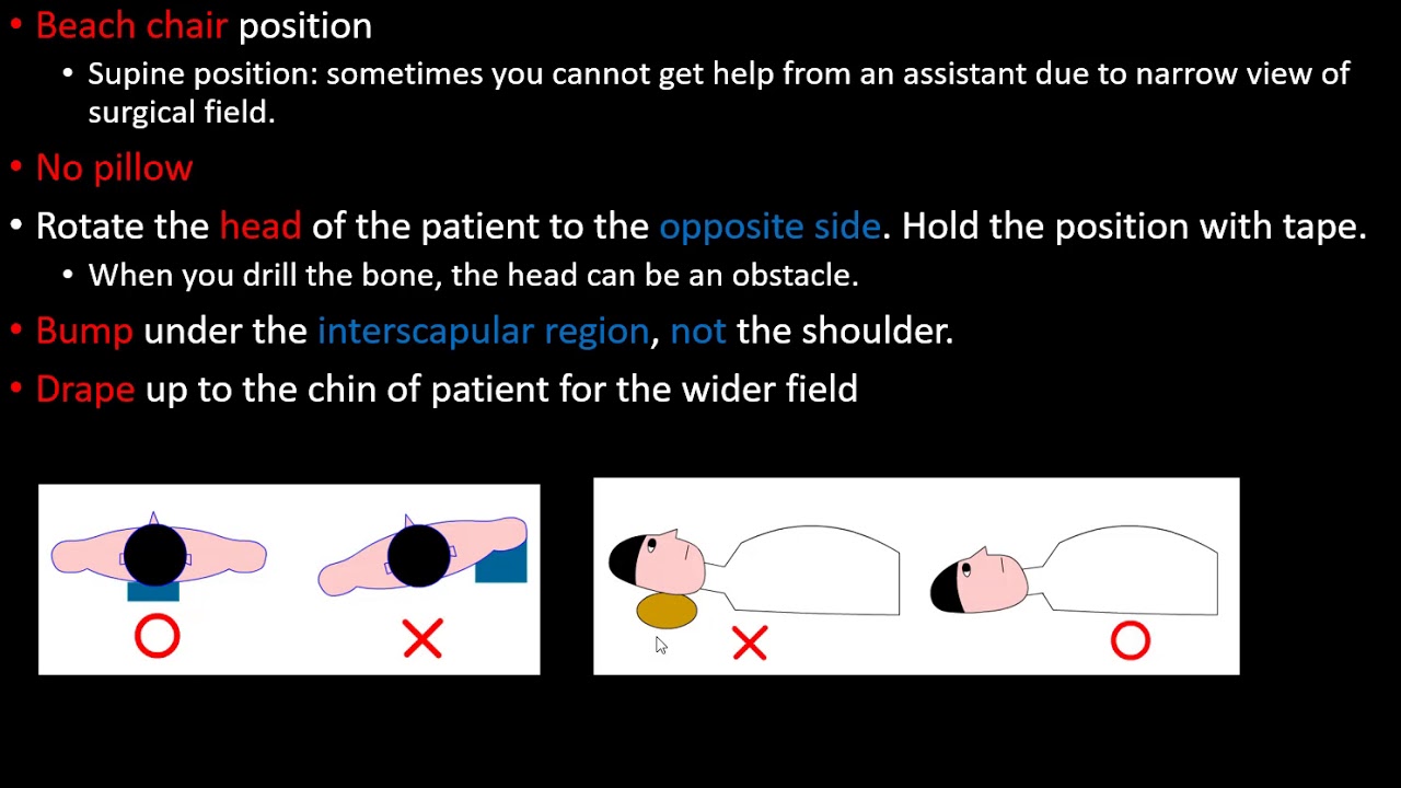 Optimal Position for ACCC injury, clavicle fracture - YouTube