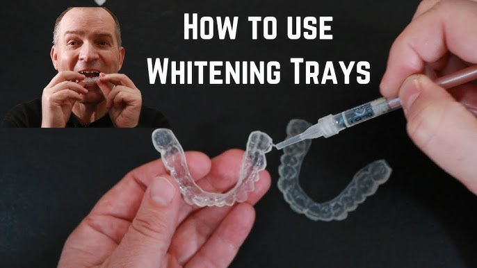 How to Use Opalescence Tooth Whitening - Baird Orthodontics