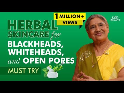 How To Get Rid Of Blackheads, Whiteheads, And Open Pores Naturally | Natural Skincare Remedies