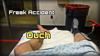 Freak Motorcycle Accident Put Me In The Hospital | ZX6R, R6, R1 & S1000RR Group Ride