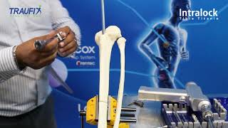 Taller de Clavo Intramedular para Tibia Intralock de Traufix