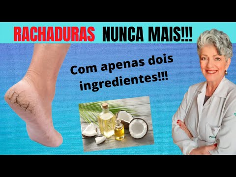 Vídeo: O óleo de coco ajuda nos calcanhares rachados?