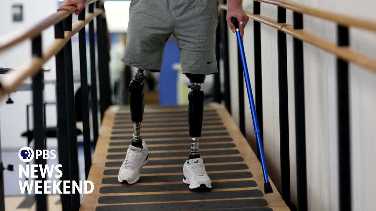 Why insurance companies are denying coverage for prosthetic limbs