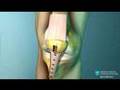 Anterior Cruciate Ligament (ACL) Reconstruction Animation