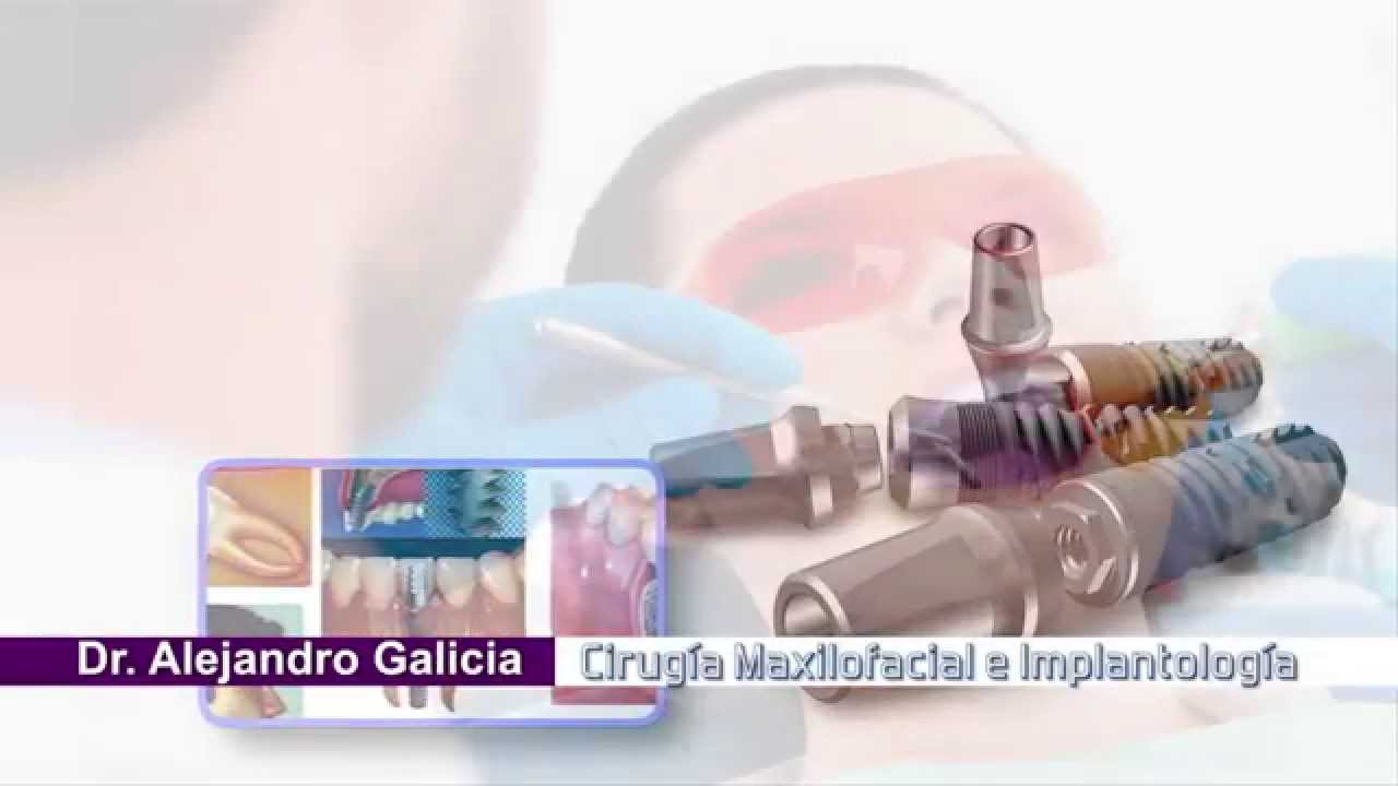 Cirugía Oral y Maxilofacial de Terceros Molares:Dr. Alejandro Galicia