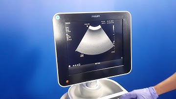 Sale 51723 - Lot 6 - Philips Sparq Ultrasound
