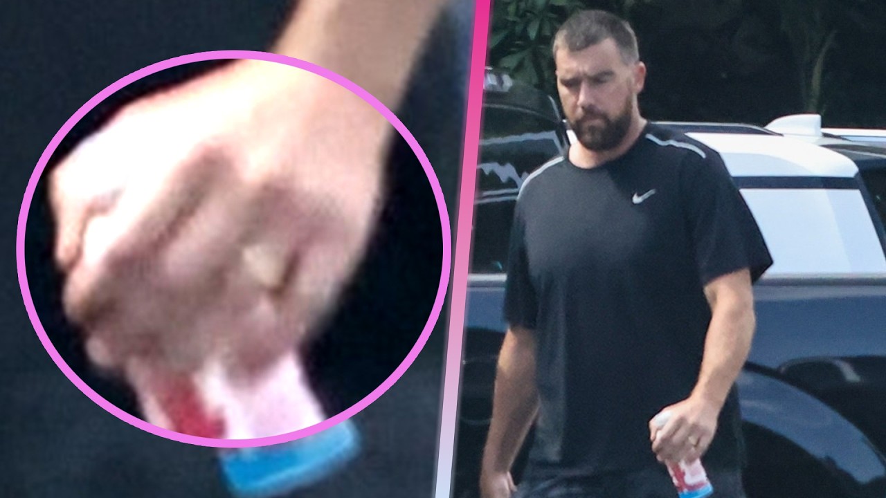 Travis Kelce Debuts Wedding Ring From Taylor Swift at Chiefs Training