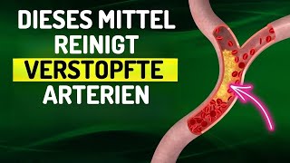 Dieses natürliche Mittel reinigt verstopfte Arterien und kontrolliert den Blutdruck!