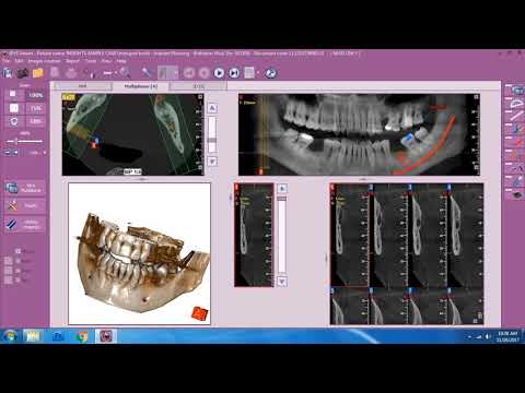 Insights Diagnostic - iRys Software Tutorial Video - Opening and Copying Files