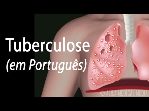 Tuberculose: Infecção Latente e Doença Ativa, Animação. Alila Medical Media Português