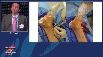 Stern D2 - USG-Guided Pedal Access Technique - Dr. Fadi Saab