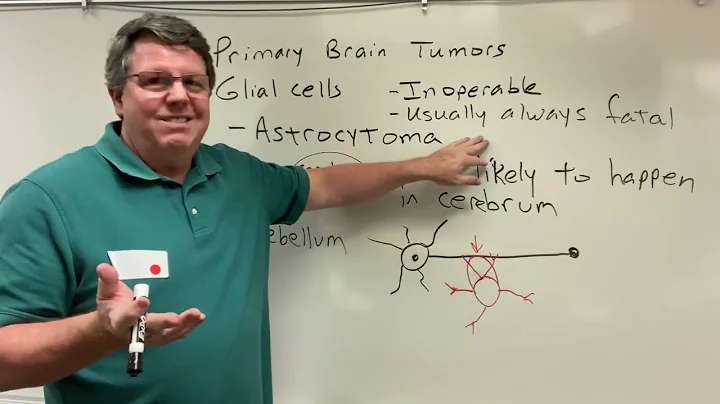Astrocytoma, A Simple Explanation