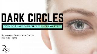 Why Do I Have Dark Circles Under My Eyes?