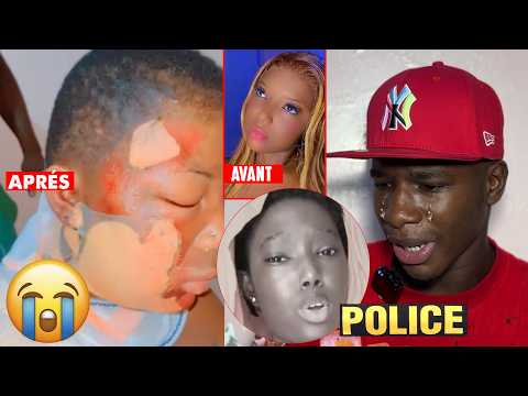 Kawtef Astou Ngom Burned Alive By What She Called Her Sister Her Friend Poured Water On Her