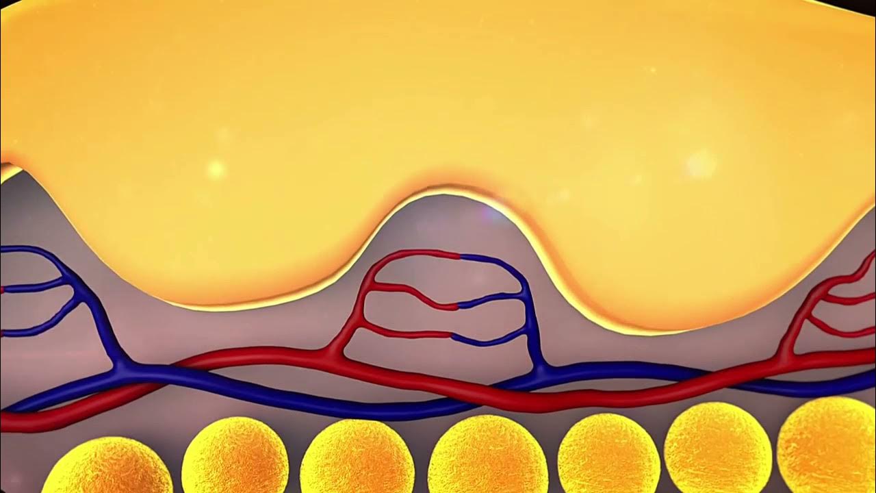 Laser Lipo Certification and Training Courses YouTube