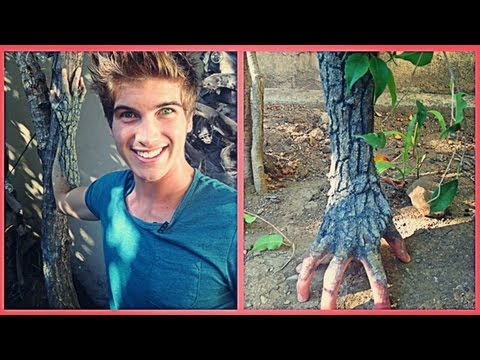 PEETA TREE ARM!