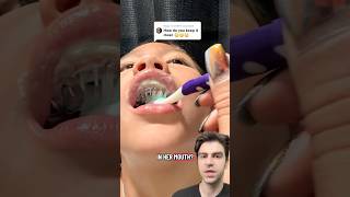 Wait… What Is ALL That In Her Mouth?!