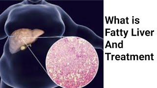 What Is Fatty Liver And How We Can Treat It Without Medicines