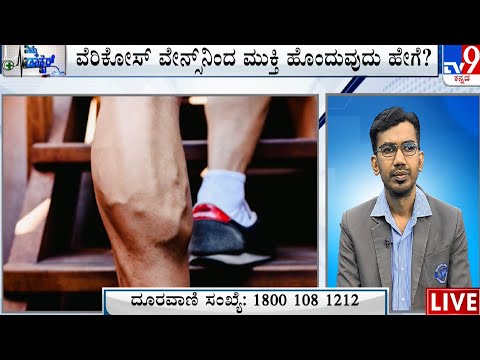 Nimma Doctor | Treatment For Varicose Veins | Homeocare International (15-07-2023)