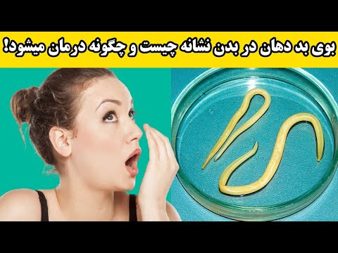 بوی بد دهان در بدن نشانه چیست و چگونه درمان میشود