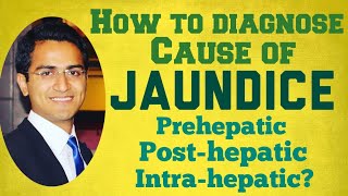 Jaundice Diagnostic Workup  Causes, Symptoms & Treatment