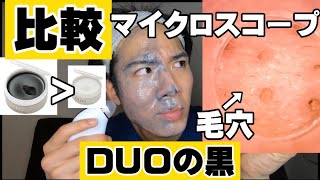 【いちご鼻】DUO従来の物と新作の黒顔面半分検証‼️