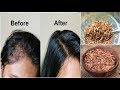 Your Hair Will Grow Like Crazy! Just Eat 1 TableSpoon Daily for Hair Growth, FLAXSEEDS for Long Hair