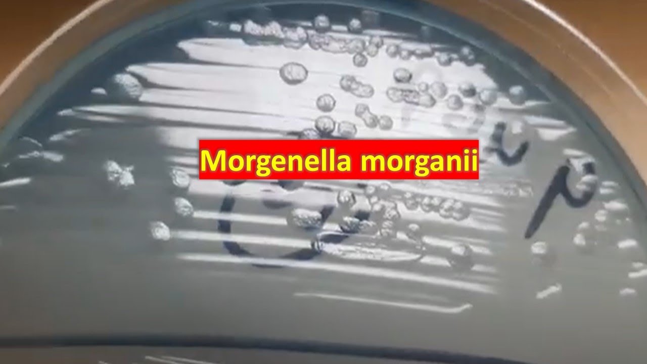 Morphology on CLED agar Demonstration YouTube