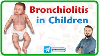 Bronchiolitis in Children : Etiology, Clinical features, Diagnosis, Management and Complications