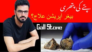 Gallbladder Stones Signs Symptoms and Treatment in Urdu and Hindi || पित्त पथरी लक्षण लक्षण और उपचार