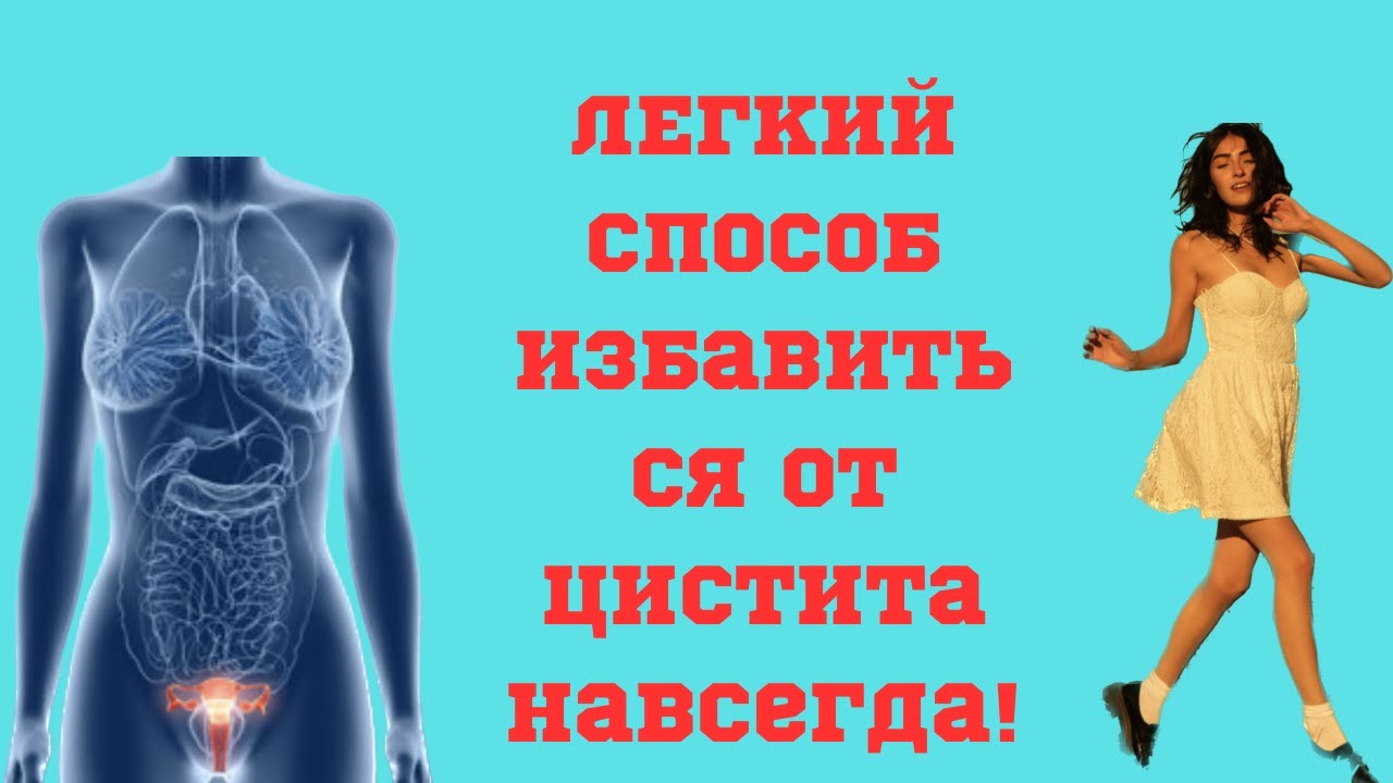 Легкий способ избавиться от ЦИСТИТА. - YouTube